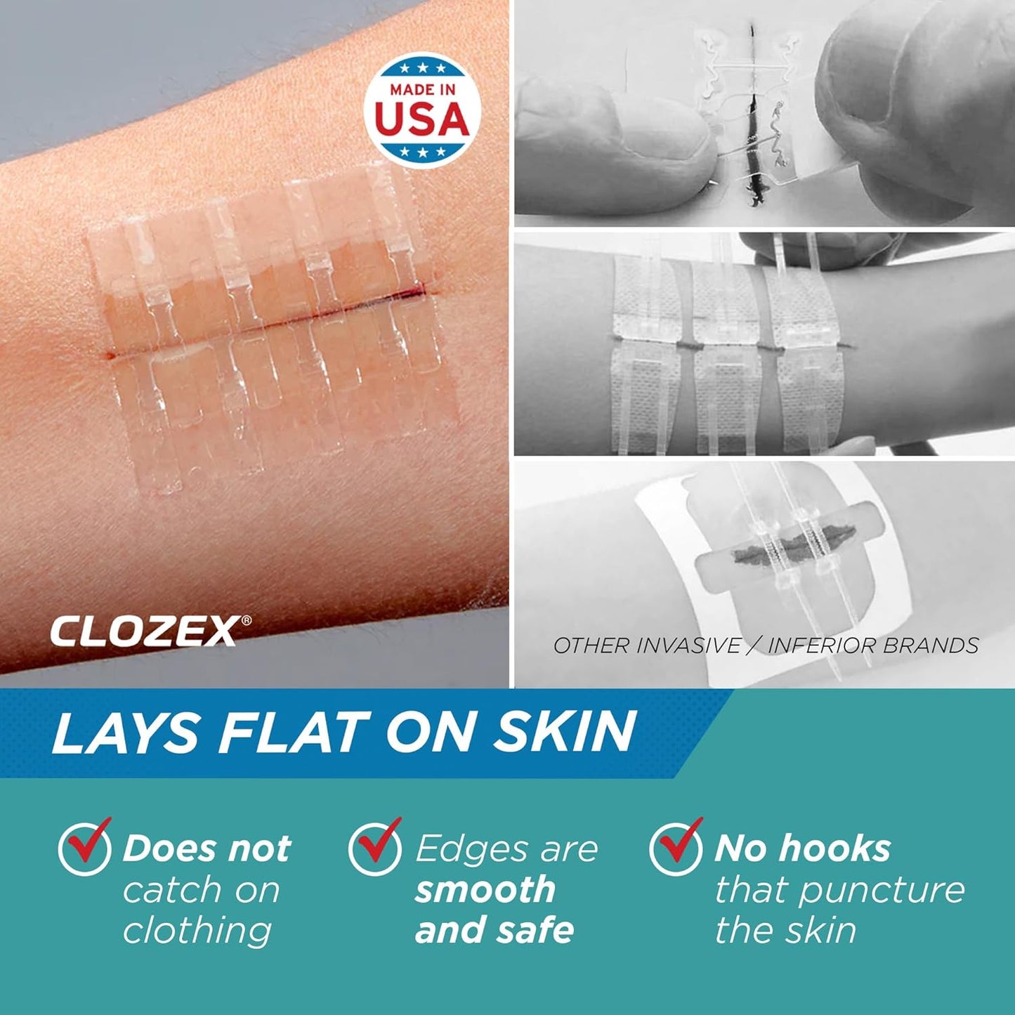 Clozex Pediatric Laceration Closures - Repair Wounds Without Stitches, FSA HSA Eligible Skin Closure Device for 3 Individual Wounds Or Combine for Total Length of 2 3/8 Inches