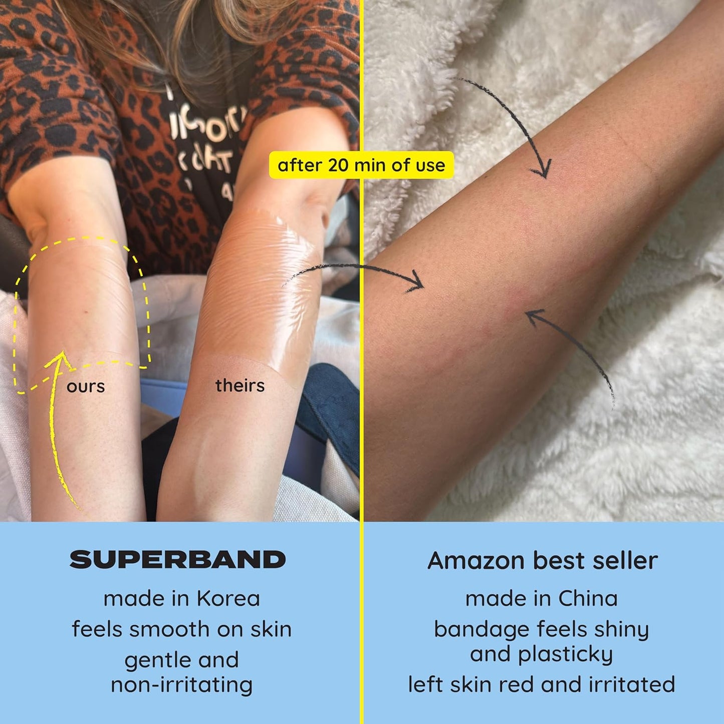 SUPERBAND Premium Hydrocolloid Bandages HSA FSA Eligble Waterproof Wound Dressing by MakeItSkin | Thin, Fast Healing, Scar Reducing for Scratches, Cuts, Burns, Blisters, Fissures, Road Rashes