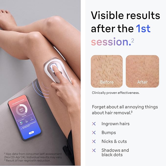 Braun IPL Skin i·Expert, at Home Laser Hair Removal, Permanent Visible Hair Reduction, with Free App, Smart IPL, Vanity Case, Venus Razor, 2 Smart Heads, Facial Trimmer, PL7219